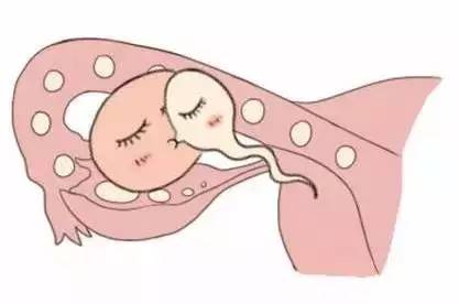 胚胎培养室